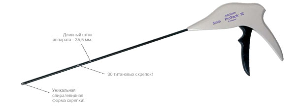 Эндоскопический герниостеплер ProTack™ 5 mm (Single Use Instrument)  AutoSuture : Covidien